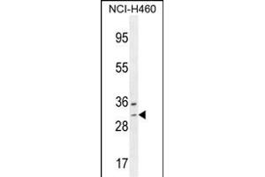 WBSCR27 Antibody (N-term) (ABIN654505 and ABIN2844234) western blot analysis in NCI- cell line lysates (35 μg/lane). (WBSCR27 anticorps  (N-Term))