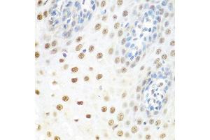 Immunohistochemistry of paraffin-embedded human esophagus using DDX39B antibody at dilution of 1:100 (40x lens). (DDX39B anticorps)