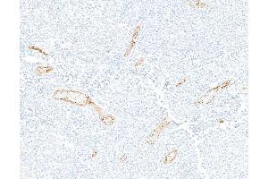 Immunohistochemistry (IHC) image for anti-Selectin P (Granule Membrane Protein 140kDa, Antigen CD62) (SELP) (AA 42-771) antibody (ABIN7795665)