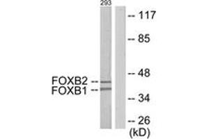 Western blot analysis of extracts from 293 cells, using FOXB1/2 Antibody. (FOXB1/2 anticorps  (AA 51-100))