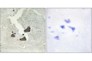 Immunohistochemistry analysis of paraffin-embedded human brain tissue, using EPHB6 Antibody.