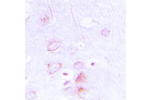 Immunohistochemical analysis of EPB41L2 staining in human brain formalin fixed paraffin embedded tissue section. (EPB41L2 anticorps  (Center))