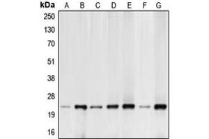Western blot analysis of BIM expression in HeLa (A), K562 (B), Raji (C), HEK293T (D), MCF7 (E), mouse kidney (F), rat kidney (G) whole cell lysates. (BIM anticorps  (N-Term))
