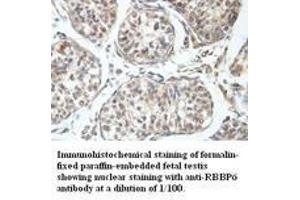 Image no. 1 for anti-Retinoblastoma Binding Protein 6 (RBBP6) antibody (ABIN791194) (RBBP6 anticorps)