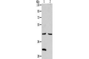 Western Blotting (WB) image for anti-Neutral Cholesterol Ester Hydrolase 1 (NCEH1) antibody (ABIN2422362) (NCEH1 anticorps)