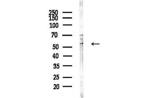anti-Mucin 13, Cell Surface Associated (MUC13) (C-Term) antibody