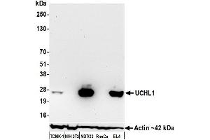 Western Blotting (WB) image for anti-Ubiquitin Carboxyl-terminal Esterase L1 (Ubiquitin Thiolesterase) (UCHL1) (AA 50-100) antibody (ABIN7449527)