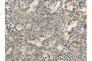 ABIN6258835 and ABIN6275157 at 1/100 staining human pituitary adenoma by IHC-P.