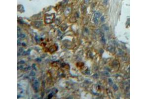 Used in DAB staining on fromalin fixed paraffin-embedded Lung tissue