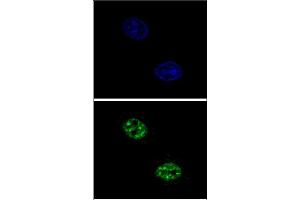 Confocal immunofluorescent analysis of USF1 Antibody (Center) with Hela cell followed by Alexa Fluor 488-conjugated goat anti-rabbit lgG (green). (USF1 anticorps  (Middle Region))