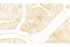 Detection of MSLN in Human Skeletal muscle Tissue using Polyclonal Antibody to Mesothelin (MSLN)