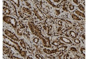 ABIN6277736 at 1/100 staining Human kidney tissue by IHC-P. (GLI1 anticorps  (C-Term))