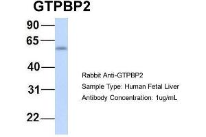 Host:  Rabbit  Target Name:  GTPBP2  Sample Type:  Human Fetal Liver  Antibody Dilution:  1. (GTPBP2 anticorps  (N-Term))