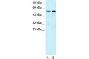 Western Blotting (WB) image for anti-Serotonin Receptor 1A (HTR1A) antibody (ABIN2463750) (Serotonin Receptor 1A anticorps)
