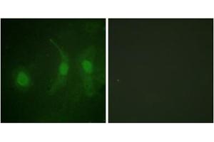 Immunofluorescence analysis of HeLa cells, using IRF3 (Phospho-Ser385) antibody. (IRF3 anticorps  (pSer385))