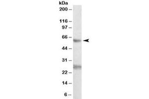 Western blot testing of K562 lysate with EIF2B4 antibody at 0. (EIF2B4 anticorps)