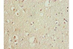 Immunohistochemistry of paraffin-embedded human brain tissue using ABIN7165174 at dilution of 1:100 (TNRC5 anticorps  (AA 31-278))