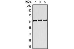 Western blot analysis of ATF7 expression in Jurkat (A), Raw264. (AFT7 anticorps  (Center))