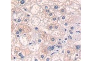 IHC-P analysis of Human Tissue, with DAB staining. (TGM1 anticorps  (AA 496-760))