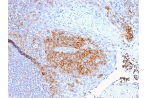 Formalin-fixed, paraffin-embedded human Tonsil stained with CD27 Mouse Monoclonal Antibody (LPFS2/1611).