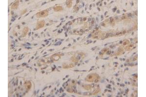 DAB staining on IHC-P; Samples: Human Stomach Tissue (AGR2 anticorps  (AA 21-175))