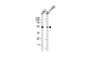 CHEK2 Antibody (N-term) (ABIN1881196 and ABIN2840120) western blot analysis in K562,NCI- cell line lysates (35 μg/lane). (CHEK2 anticorps  (N-Term))