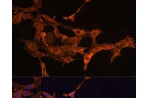 Immunofluorescence analysis of C6 cells using DCN Polyclonal Antibody at dilution of 1:100 (40x lens).