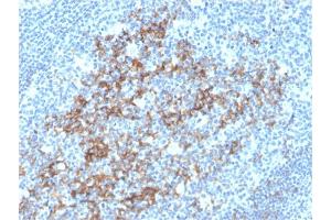 Formalin-fixed, paraffin-embedded human Tonsil stained with CD23-Monospecific Mouse Monoclonal Antibody (FCER2/3592). (FCER2 anticorps  (AA 48-321))