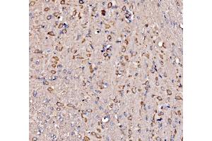 IHC analysis of RPL17 using anti-RPL17 antibody (ABIN7601639).