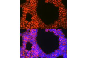 Immunofluorescence analysis of Jurkat cells using CD70 Rabbit pAb (ABIN3022742, ABIN3022743, ABIN3022744, ABIN1512720 and ABIN6219205) at dilution of 1:100 (40x lens).