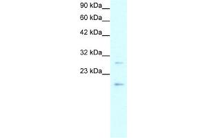 WB Suggested Anti-CLDN1 Antibody Titration:  0. (Claudin 1 anticorps  (C-Term))