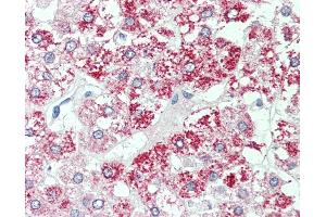 Anti-SLC7A2 antibody IHC of human adrenal.