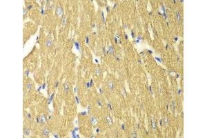 Immunohistochemistry of paraffin-embedded Mouse heart using TPM3 Polyclonal Antibody at dilution of 1:100 (40x lens). (TPM3 anticorps)