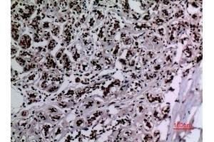 Immunohistochemical analysis of paraffin-embedded human-breast, antibody was diluted at 1:100.