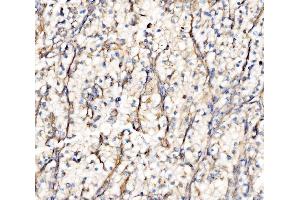 IHC analysis of Integrin Linked ILK using anti-Integrin Linked ILK antibody (ABIN7599411). (ILK anticorps  (AA 1-452))