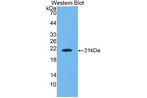 Detection of Recombinant HMMR, Human using Polyclonal Antibody to Hyaluronan Mediated Motility Receptor (HMMR)