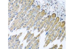 Immunohistochemistry of paraffin-embedded Mouse stomach using NDUFB10 Polyclonal Antibody at dilution of 1:100 (40x lens). (NDUFB10 anticorps)