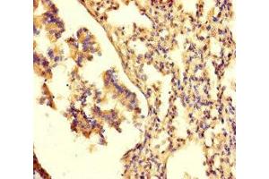 Immunohistochemistry of paraffin-embedded human lung tissue using ABIN7161472 at dilution of 1:100 (Neurotrypsin anticorps  (AA 631-874))