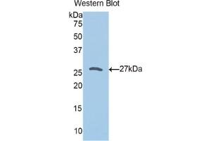 Detection of Recombinant PRDX3, Human using Polyclonal Antibody to Peroxiredoxin 3 (PRDX3) (Peroxiredoxin 3 anticorps  (AA 5-233))