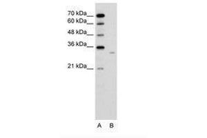 Image no. 2 for anti-Dicarbonyl/L-Xylulose Reductase (DCXR) (AA 151-200) antibody (ABIN6736636)