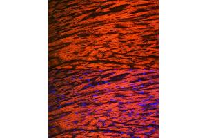 Immunofluorescence analysis of rat heart using MYL2 Rabbit mAb (ABIN7268761) at dilution of 1:100 (40x lens). (MYL2 anticorps)