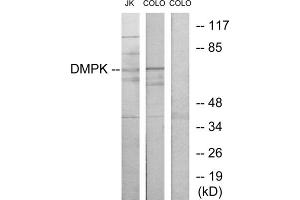 Western blot analysis of extracts from Jurkat cells and COLO205 cells, using DMPK antibody. (DMPK anticorps  (N-Term))