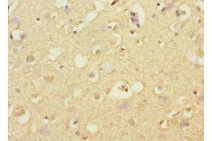 Immunohistochemistry of paraffin-embedded human brain tissue using ABIN7170731 at dilution of 1:100