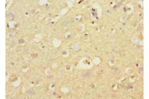 Immunohistochemistry of paraffin-embedded human brain tissue using ABIN7170731 at dilution of 1:100 (STRADA anticorps  (AA 25-210))