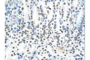 Image no. 1 for anti-RING Finger Protein 6 (RNF6) (N-Term) antibody (ABIN202860)