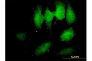 Immunofluorescence of monoclonal antibody to TOMM34 on HeLa cell. (TOMM34 anticorps  (AA 1-309))