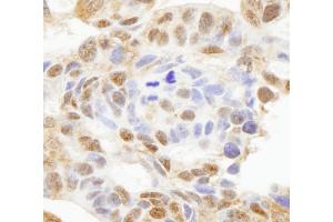 anti-Histone Deacetylase 7 (HDAC7) (AA 902-952) antibody