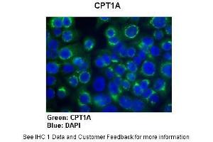 Sample Type :  Human Capan1 cells (Pancreatic cancer cell line)  Primary Antibody Dilution :  1:300  Secondary Antibody :   Anti-rabbit-AlexaFluor-488  Secondary Antibody Dilution :  1:200  Color/Signal Descriptions :  CPT1A: Green DAPI: Blue  Gene Name :  CPT1A  Submitted by :  Dr.