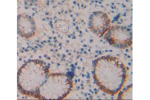 Used in DAB staining on fromalin fixed paraffin- embedded Kidney tissue