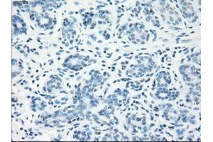 Immunohistochemical staining of paraffin-embedded breast tissue using anti-LTA4H mouse monoclonal antibody. (LTA4H anticorps)